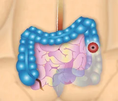 ein lila und weißes Objekt