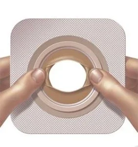 Convatec Moldable Technology™ hudbarriärer