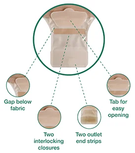 Un diagrama de una parte del cuerpo